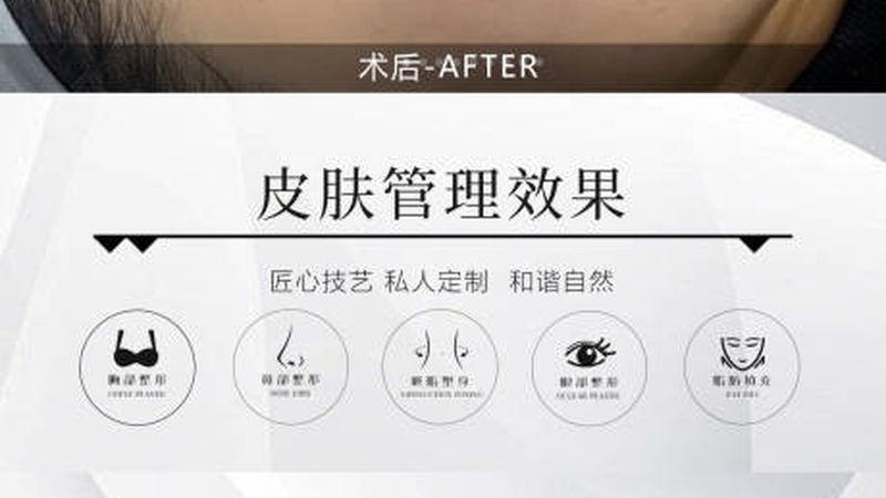 医美咨询师必备：皮肤科专业术语详解