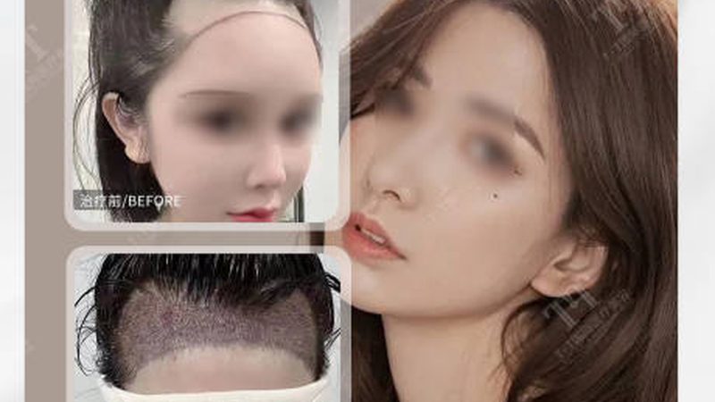 轻医美培训学校毕业证书有用吗