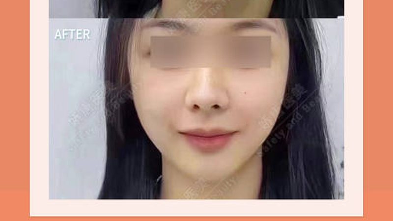 皮肤管理中心客户档案表格：如何科学管理客户信息