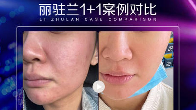 抗衰护肤品定制加盟代理，揭秘行业“黑科技