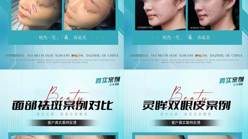 整形美容术前评估方法