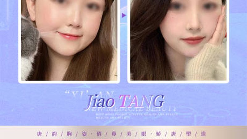 激光祛斑，揭秘十大品牌机构背后的秘密