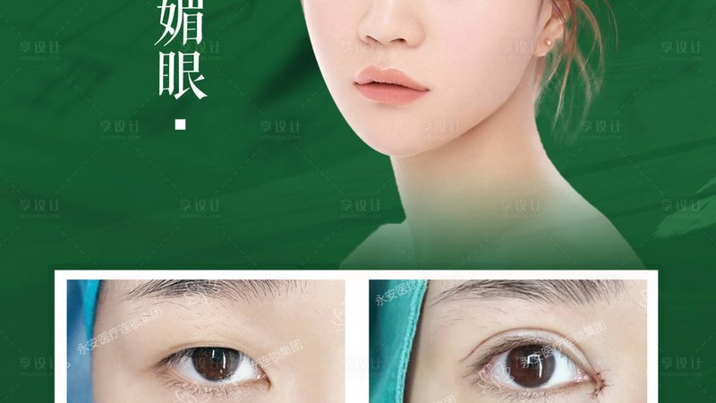 眉间纹注射除皱，这些注意事项你了解吗？**